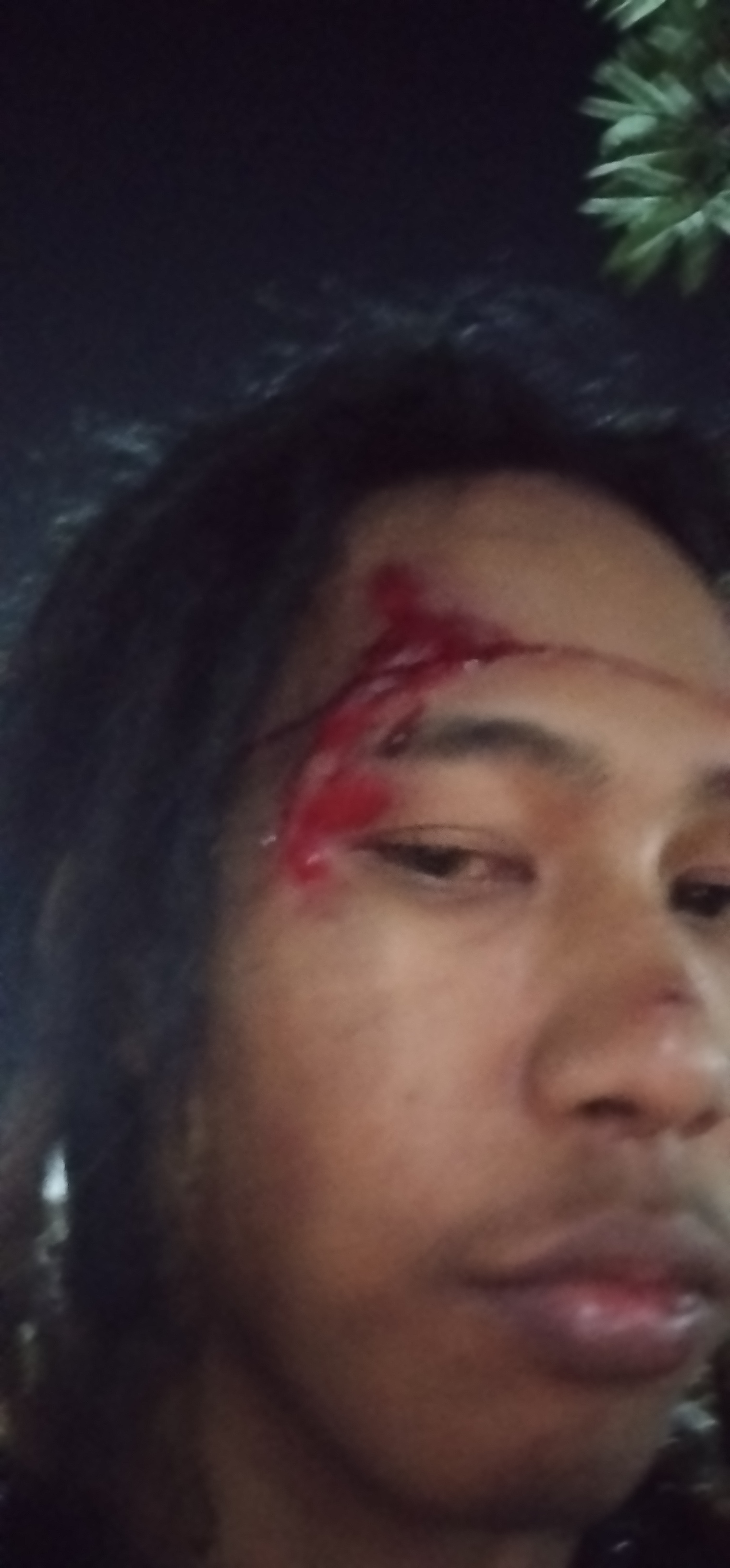 Forehead wound close-up