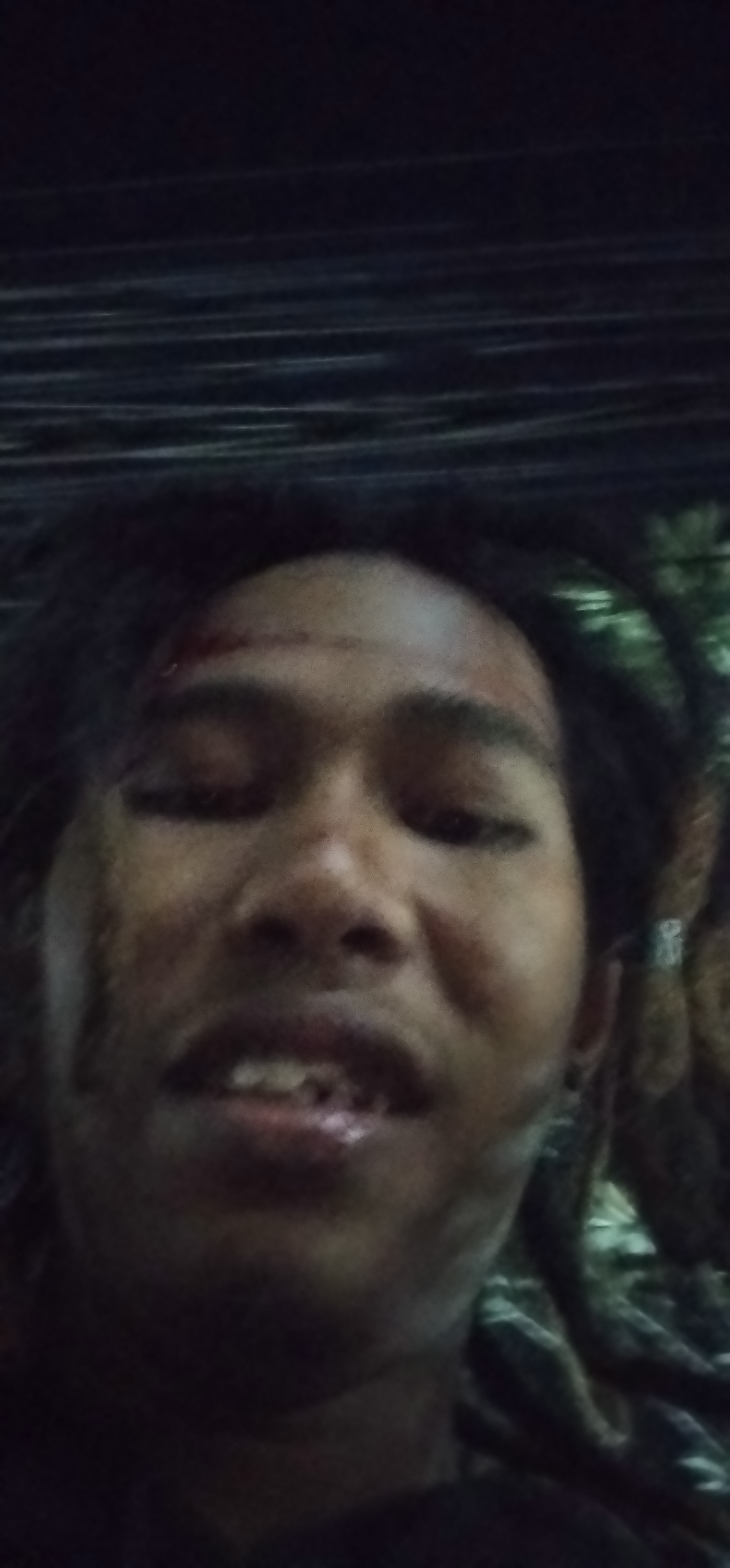 Forehead wound healing
